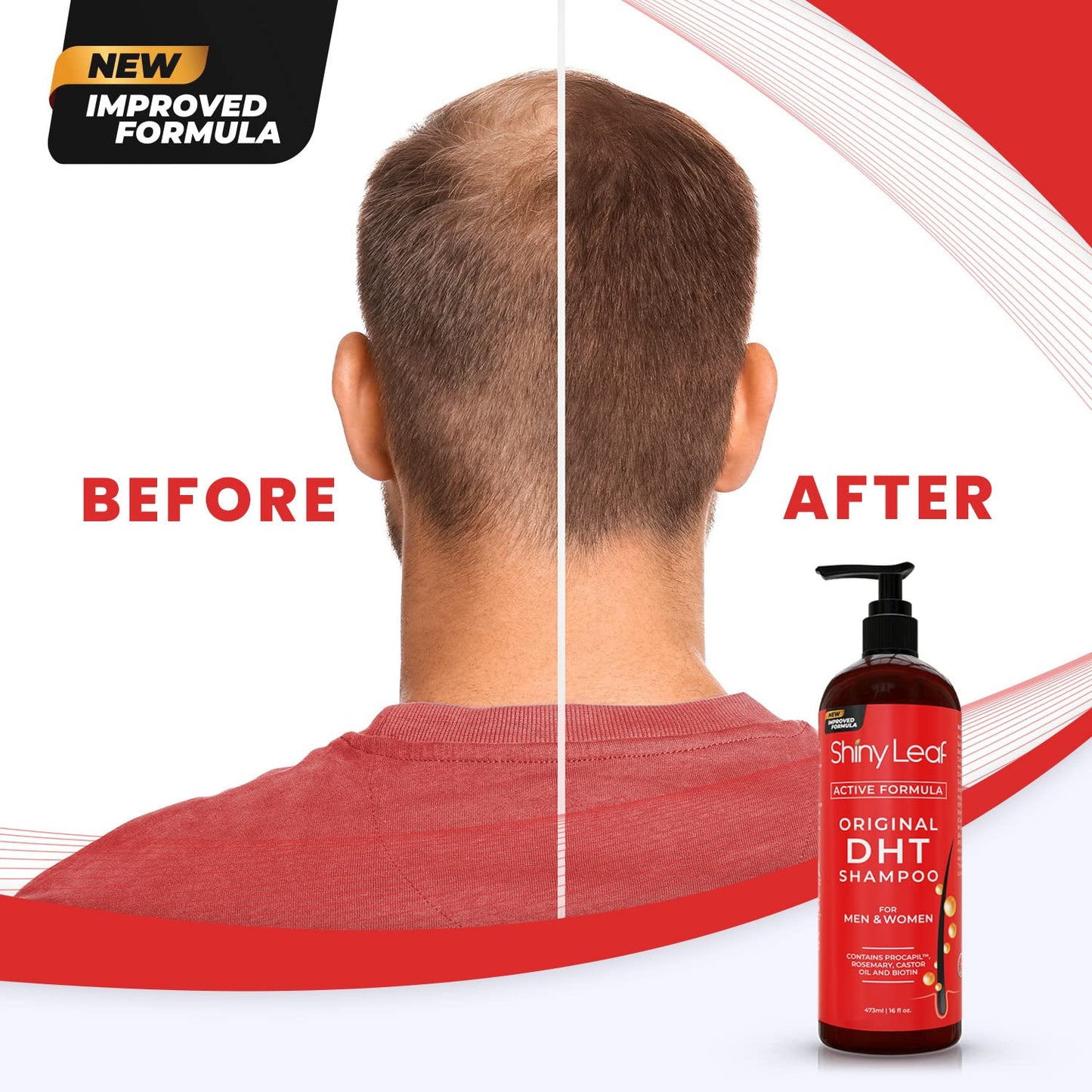 Blocker Anti Hair Loss Shampoo and Conditioner set with Biotin (2 x 16 Oz)