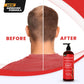Blocker Anti Hair Loss Shampoo and Conditioner set with Biotin (2 x 16 Oz)