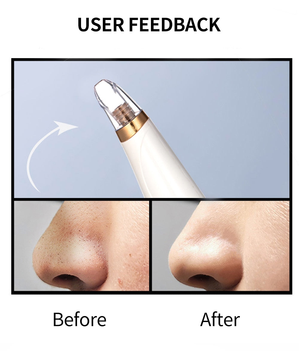 Blackhead Remover Vacuum Facial Pore Cleaner Diamond Beauty Tool