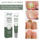 Foot Care And Thickening Nail Repair Cream. Nail Repair Cream