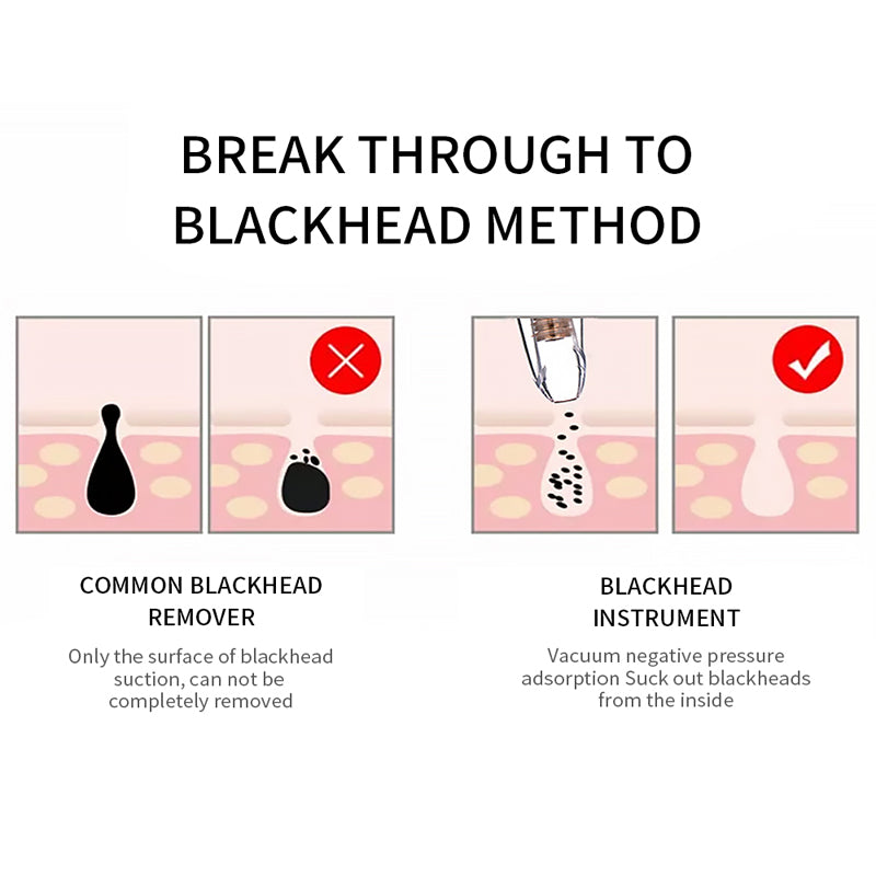 Blackhead Remover Vacuum Facial Pore Cleaner Diamond Beauty Tool