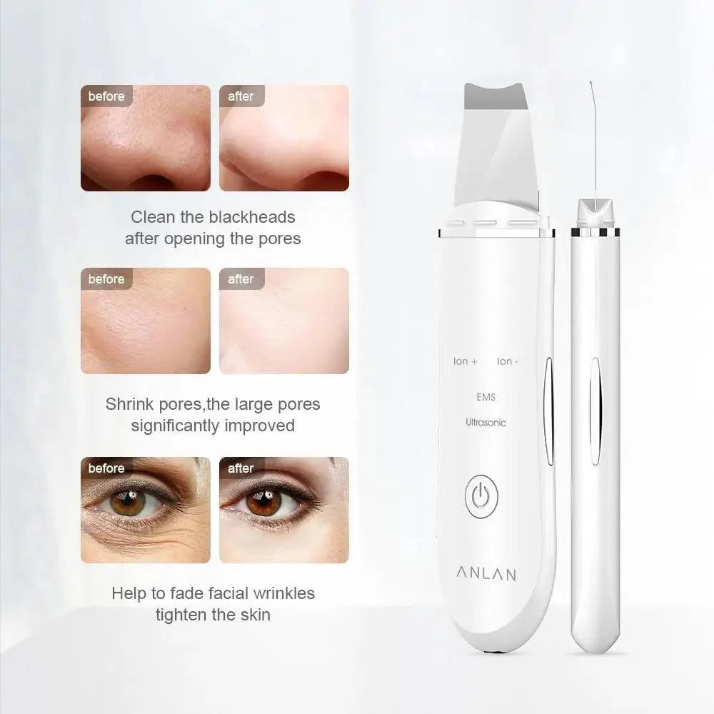 Ultrasonic Skin Scrubber Pen for Deep Face Cleansing Tool